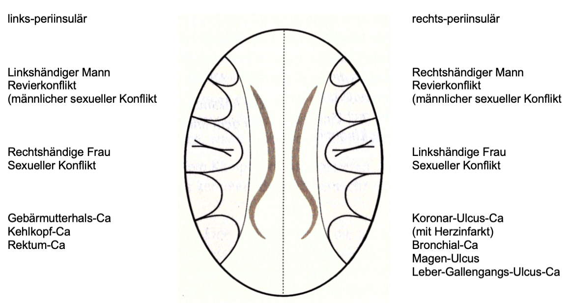 300 Schematischer CT-Schnitt durch das Grosshirn